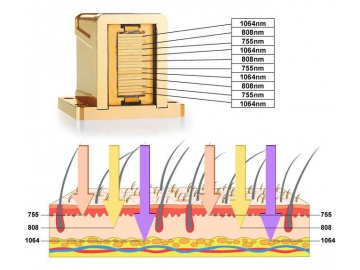 KM400D 3-Wavelength Laser Hair Removal Machine