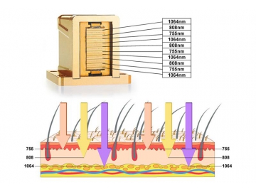 KM500D 800W Diode Laser Hair Removal Machine