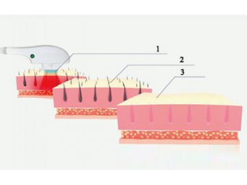 SHR/OPT/AFT Hair Removal Machine