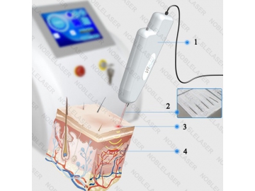 High frequency vascular removal