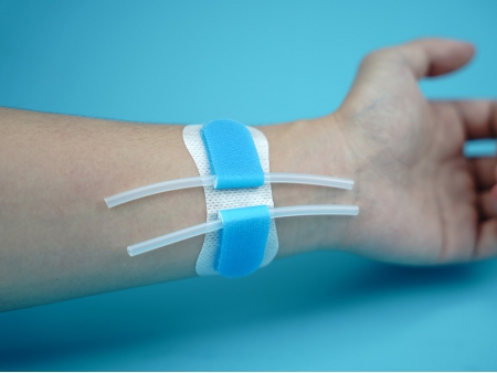 Catheter Securement Device