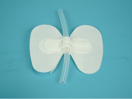 Catheter Securement Device