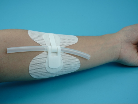 Catheter Securement Device