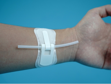 Catheter Securement Device