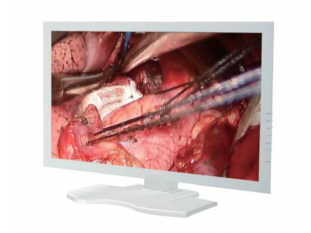 24 Inch Surgical Display Monitor