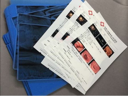 Inkjet White Medical Film  (Ultrasound Film/X-Ray Film)