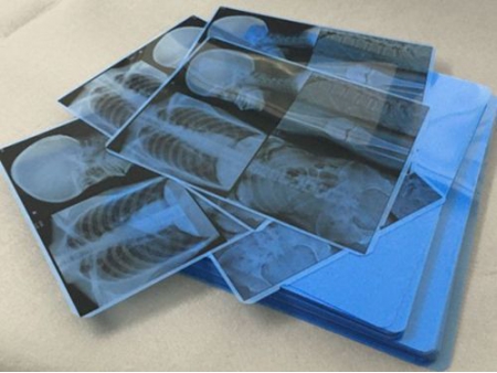 Inkjet Blue Medical Film  (X-Ray Film)