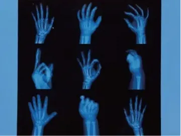 Inkjet Media