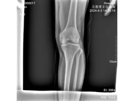 BASIC Portable X-Ray Machine