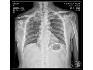 Ceiling-Mounted X-Ray Machine