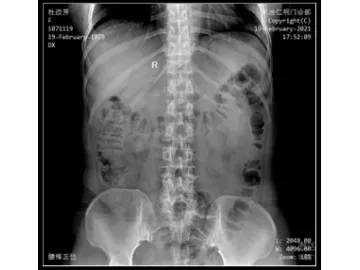 Ceiling-Mounted X-Ray Machine