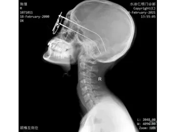 Ceiling-Mounted X-Ray Machine
