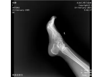 Ceiling-Mounted X-Ray Machine