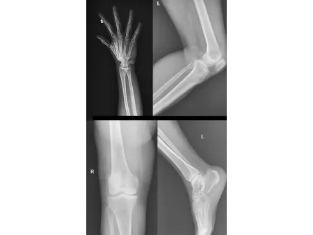 Floor-Mounted X-Ray Machine