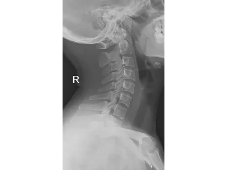 Floor-Mounted X-Ray Machine