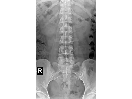 Floor-Mounted X-Ray Machine