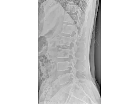 Floor-Mounted X-Ray Machine
