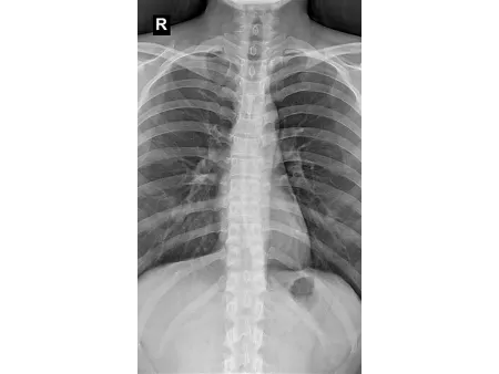 U-Arm X-Ray Machine