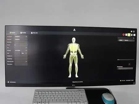 Flat Panel Detector C-Arm Machine