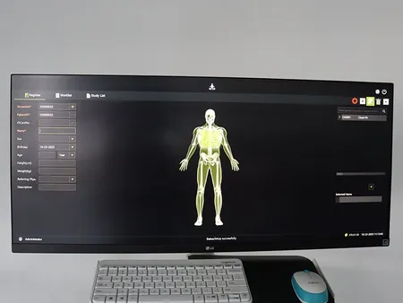 Flat Panel Detector C-Arm Machine