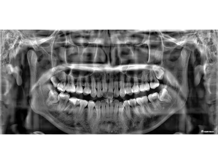 3D CBCT Machine