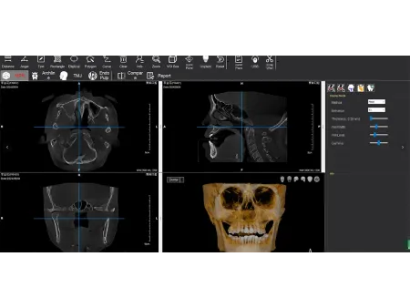 3D CBCT Machine
