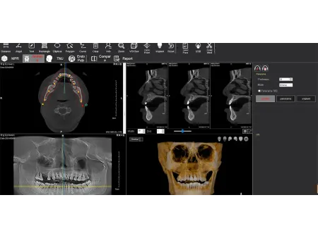 3D CBCT Machine