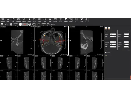 3D CBCT Machine