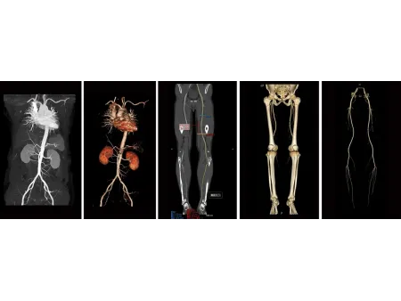 CT Scanner
