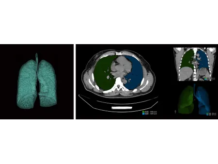 CT Scanner