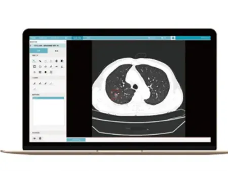 CT Scanner