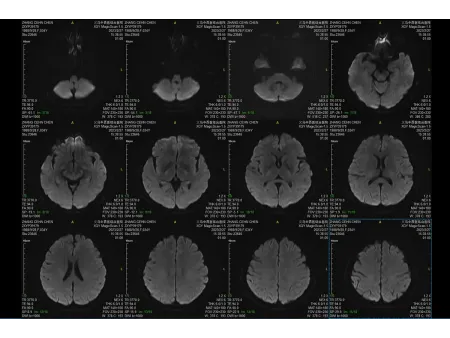 Magnetic Resonance Imaging (MRI)