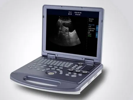 Ultrasound Machine
