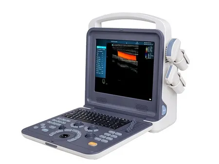Ultrasound Machine