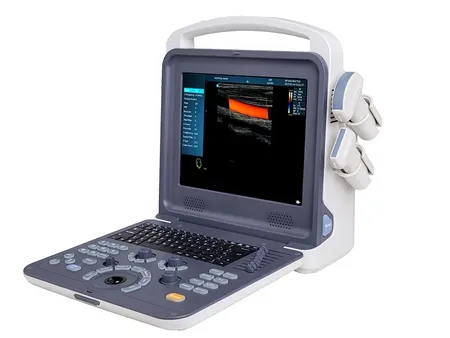 Ultrasound Machine
