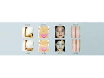 Velashape Cavitation Slimming Machine