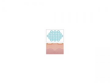 1550nm Laser for Skin Tightening, Wrinkle Removal and Scar Reduction L1550